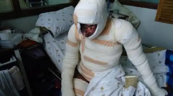 21 year old charged for pouring acid on his18 year old girlfriend